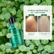 Combo làm sạch, dưỡng ẩm, chống nắng Mirum